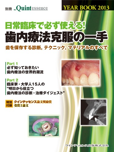 YEAR BOOK 2013　日常臨床で必ず使える！　歯内療法克服の一手