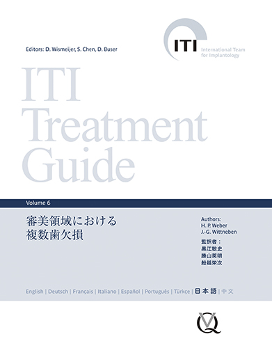 ITI Treatment Guide Volume 6　審美領域における複数歯欠損