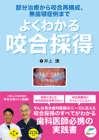 部分治療から咬合再構成、無歯顎症例まで　よくわかる咬合採得