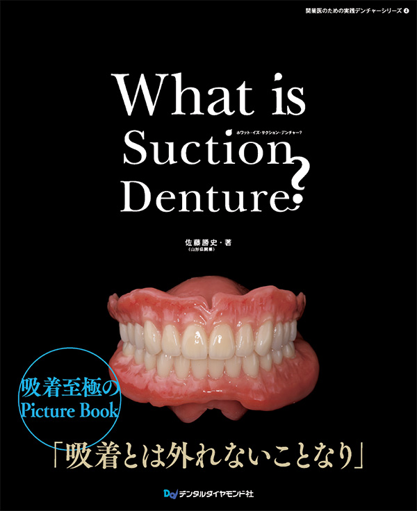 What is Suction Denture？