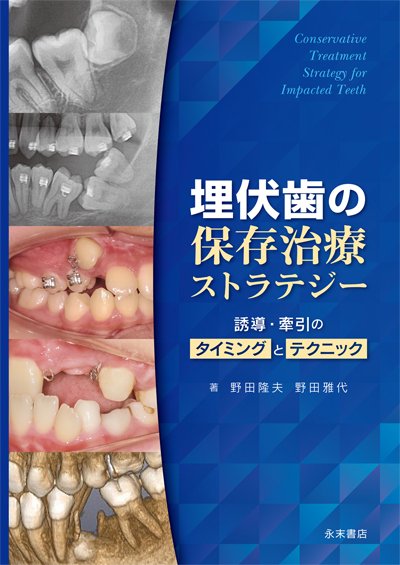 埋伏歯の保存治療ストラテジー　誘導・牽引のタイミングとテクニック