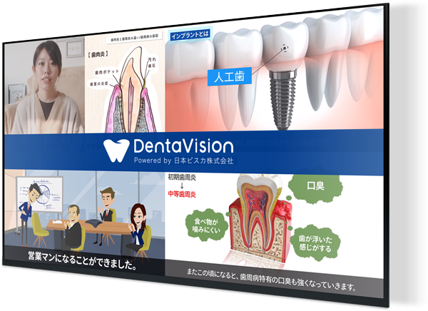 デジタルサイネージ「Denta Vision」