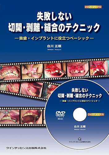 失敗しない切開・剥離・縫合のテクニック