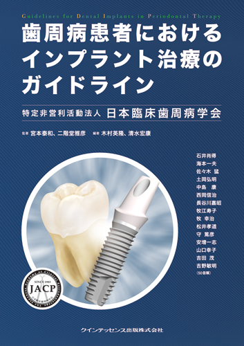 歯周病患者におけるインプラント治療のガイドライン