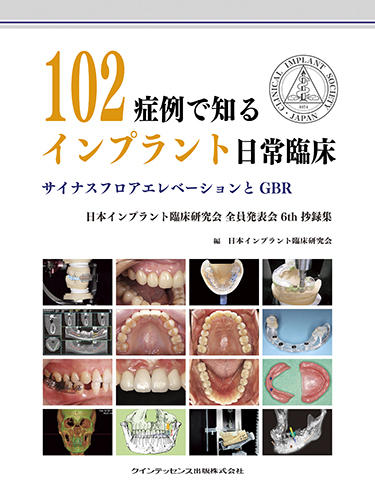 102症例で知るインプラント日常臨床