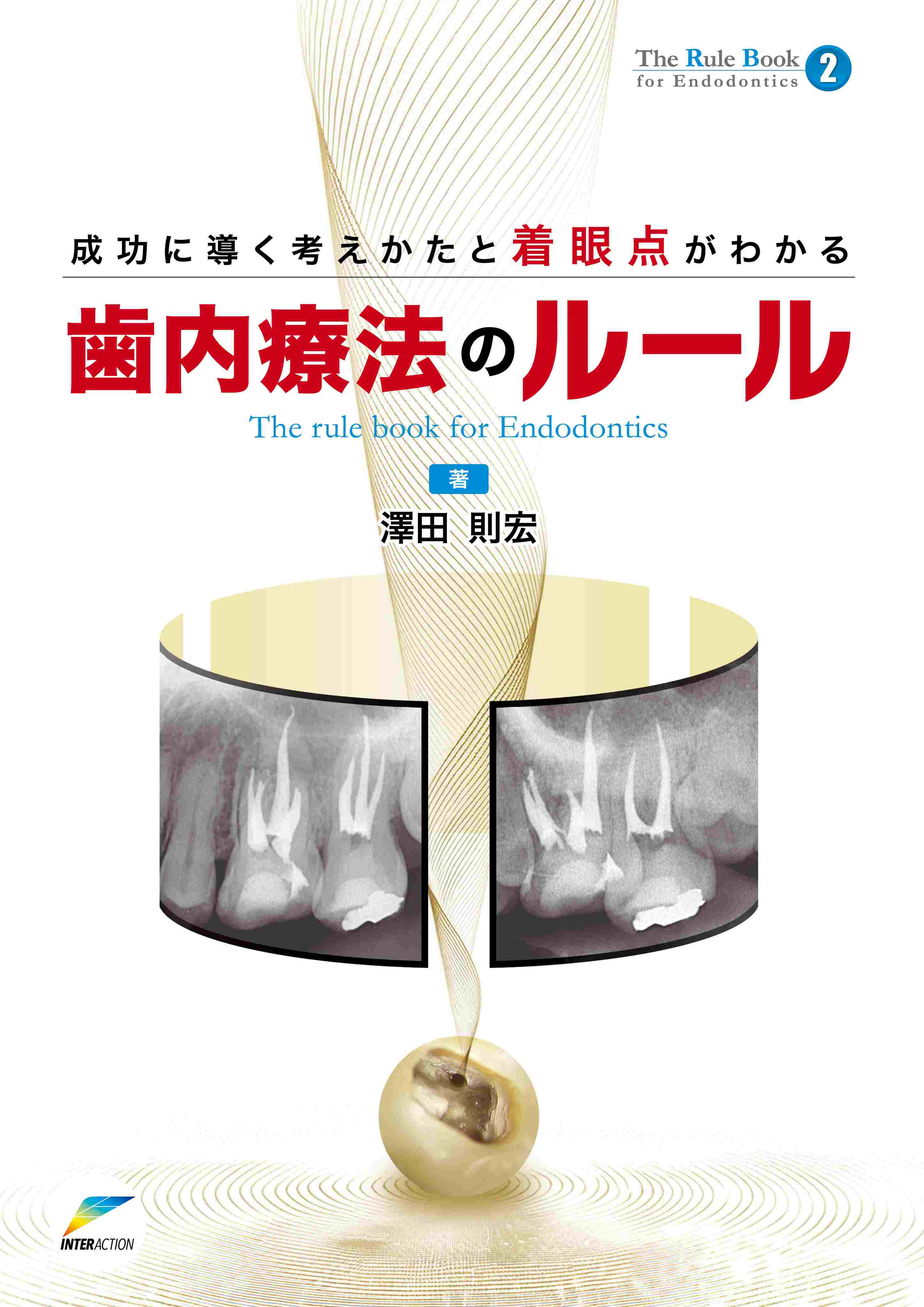 成功に導く考え方と着眼点がわかる 歯内療法のルール