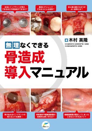 無理なくできる骨造成導入マニュアル