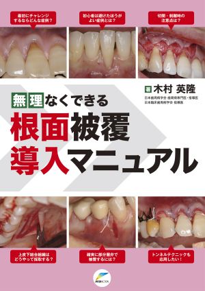 無理なくできる根面被覆導入マニュアル