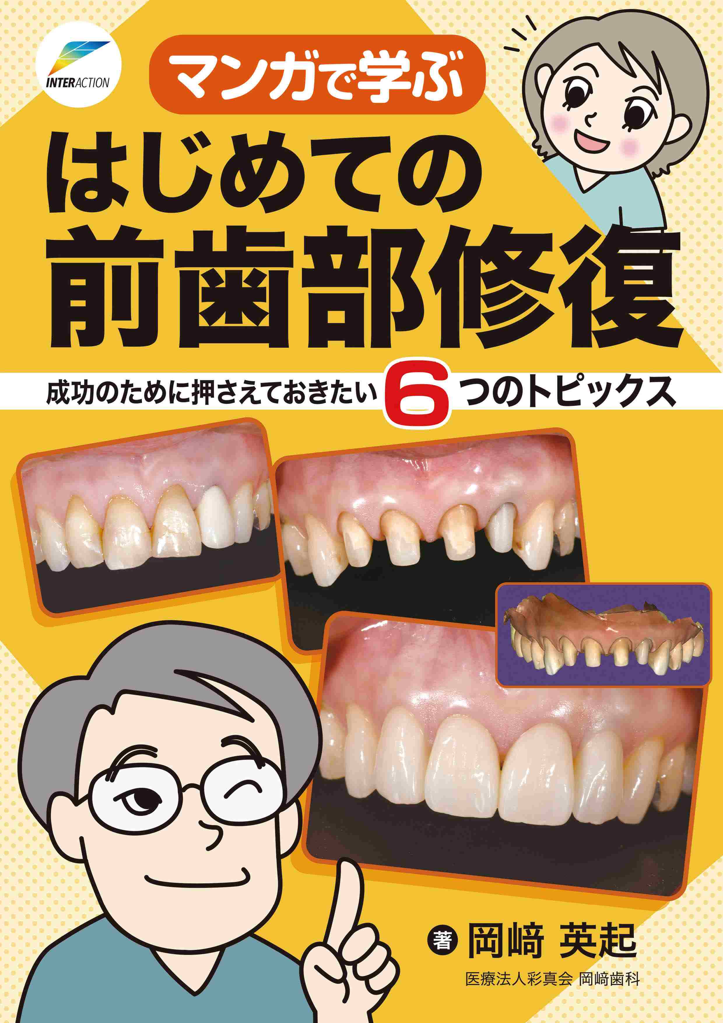 マンガで学ぶ はじめての前歯部修復 成功のために押さえておきたい6つのトピックス