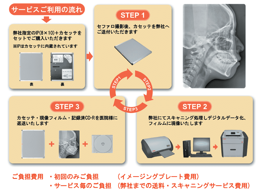 セファロデジタルスキャニングサービス