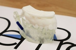 【歯科用AR/3D模型作成サービス】DenPre 3D Lab