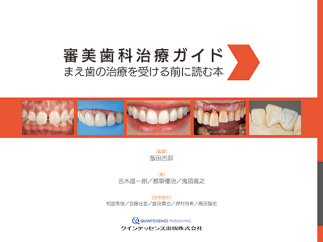 審美歯科治療ガイド