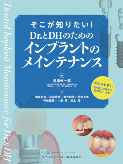 そこが知りたい! Dr.とDHのためのインプラントのメインテナンス