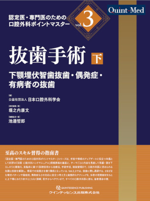 抜歯手術 下